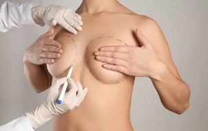 methods of breast augmentation surgery