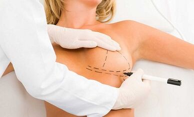 How to increase cerebral implants
