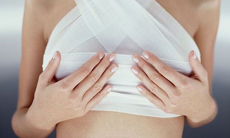 bandaged breasts after breast augmentation surgery